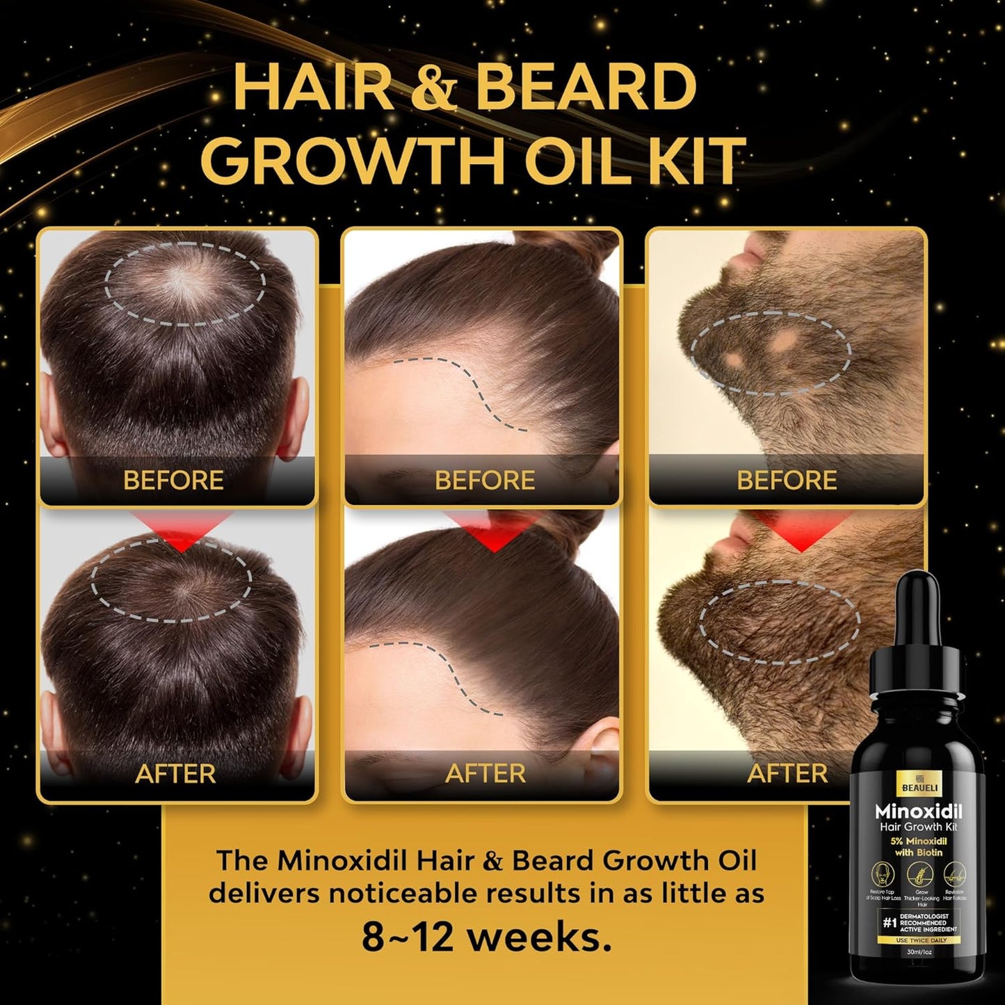 Minoxidil Zamia Original